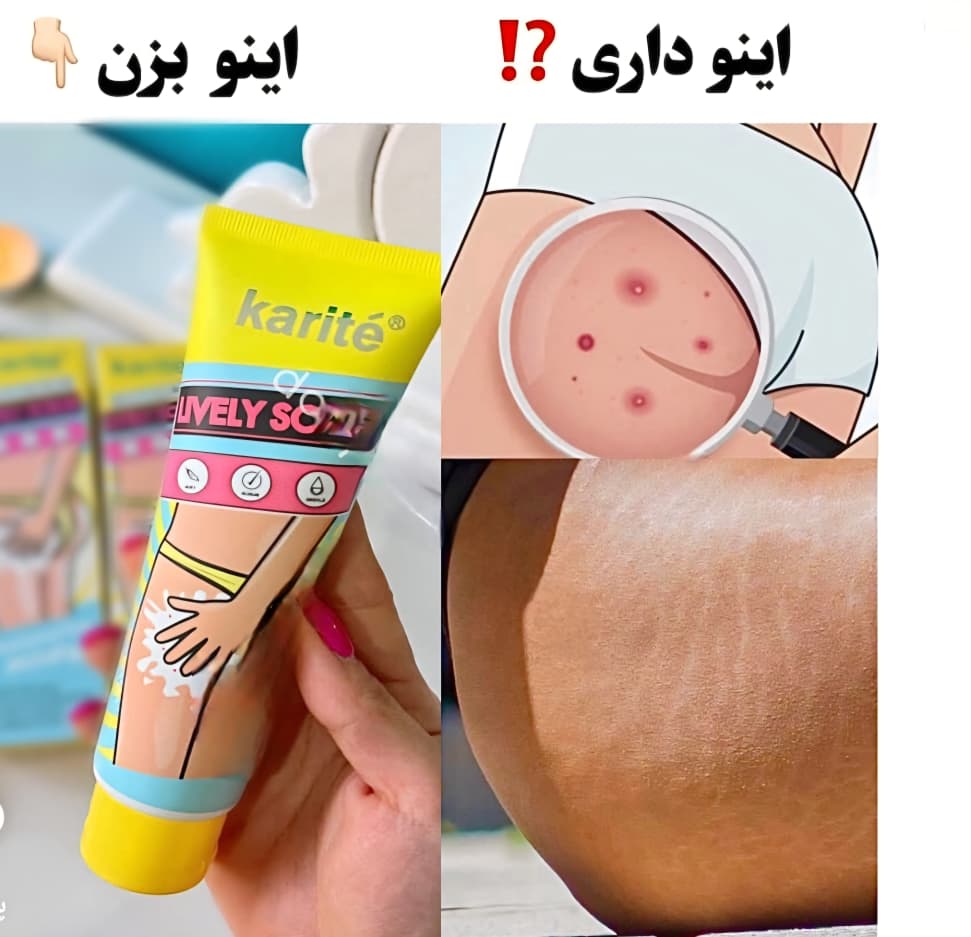 اسکراب و ضدجوش باسن کارتیه